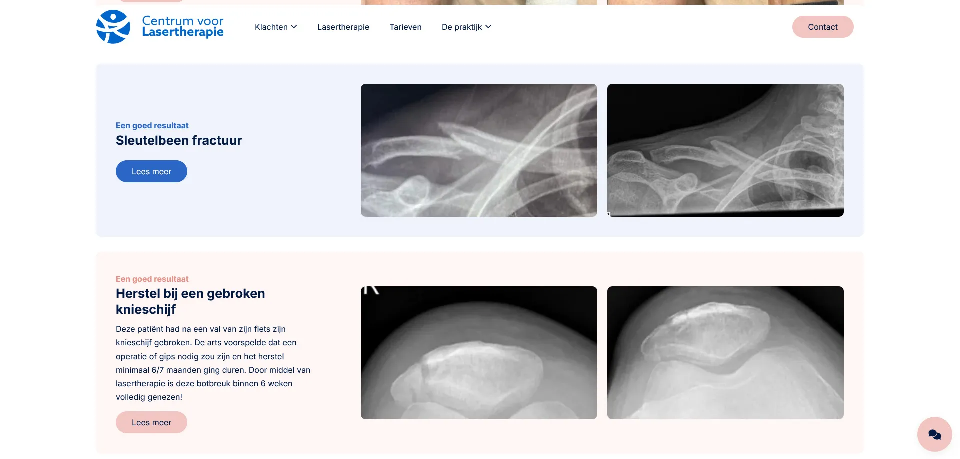 Centrum voor Lasertherapie resultaten